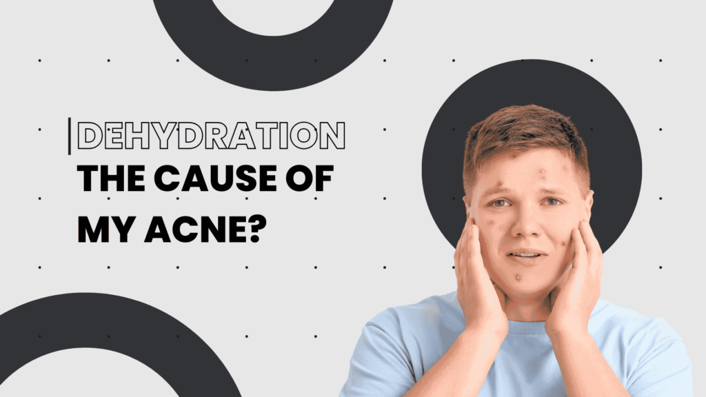 Dehydration the cause of acne?