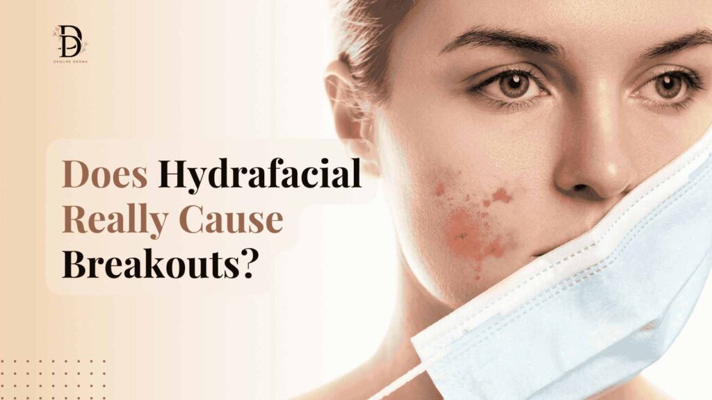 Does Hydrafacial Really Cause Breakouts?