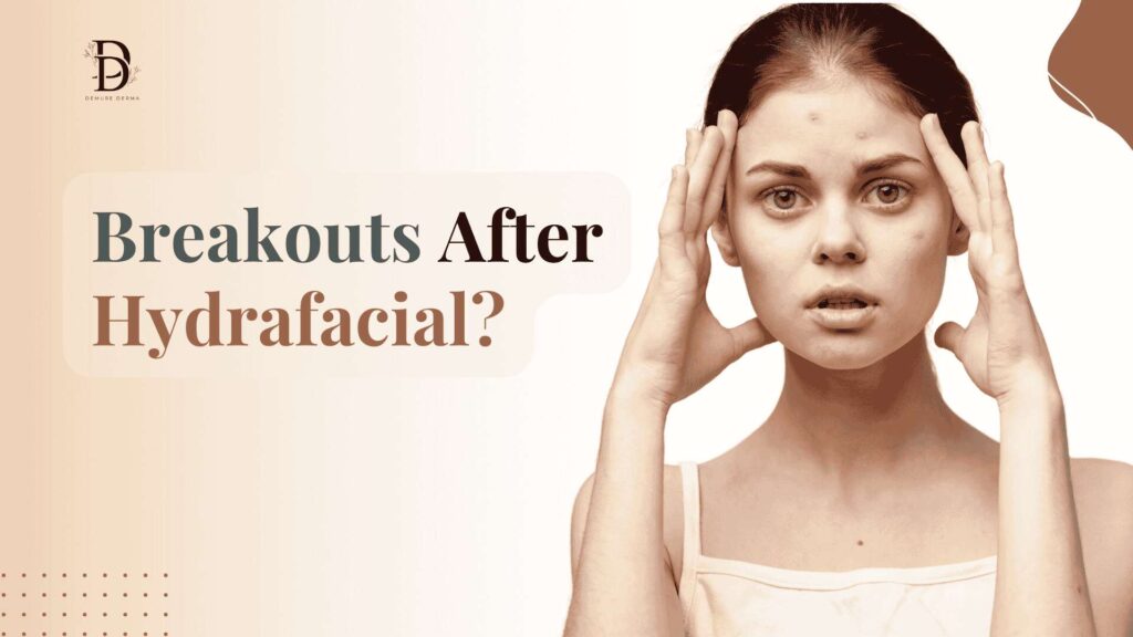 Breakouts After Hydrafacial?