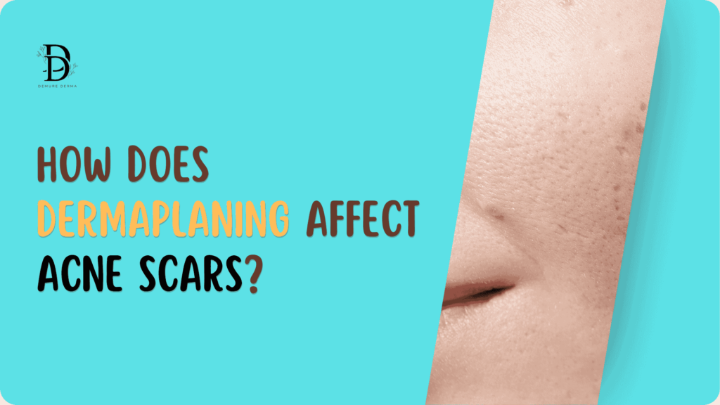 How Does Dermaplaning Affect Acne Scars? 