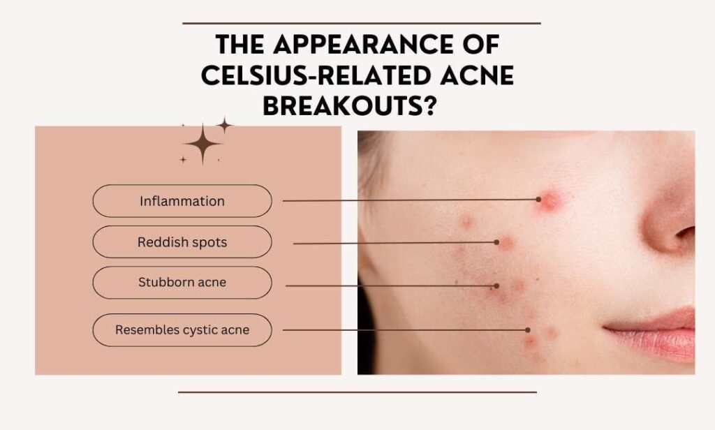 appearance of celsius breakouts