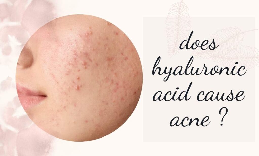does hyaluronic acid cause acne 