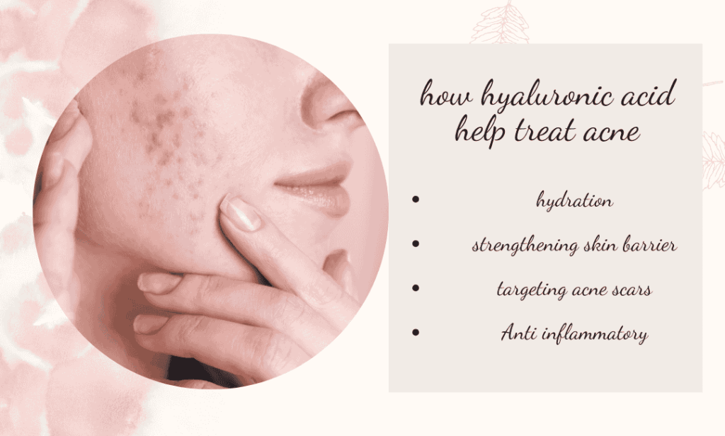 how hyaluronic acid help treat acne 