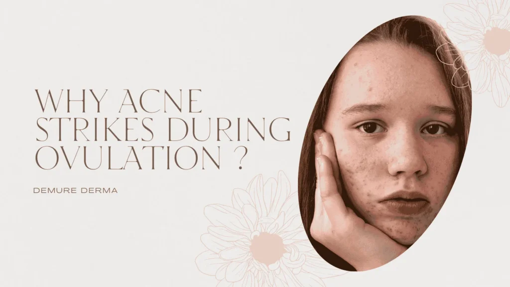 Why Acne Strikes During Ovulation?