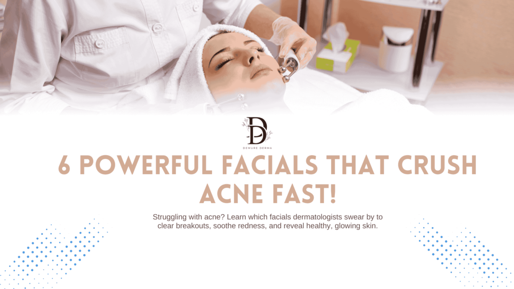 Powerful facials that crush acne fast