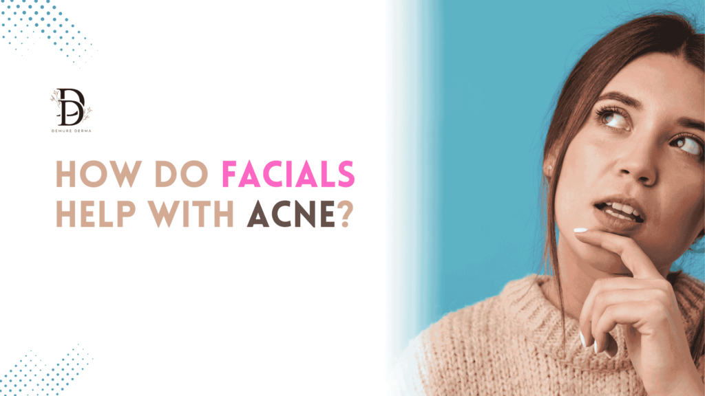 How do facials help with acne?