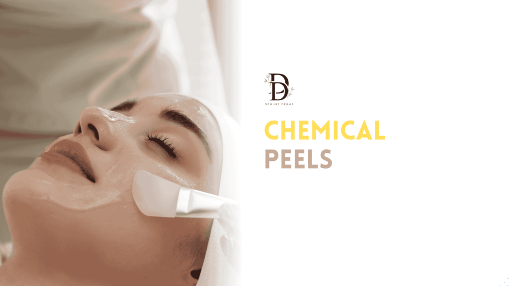 Chemical Peels